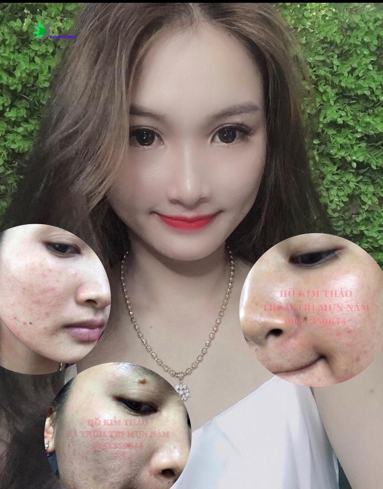 Từ một bà mẹ bỉm sữa chưa có gì nổi trội đã lột xác về nhan sắc và kiếm thêm thu nhập khủng từ kinh doanh online