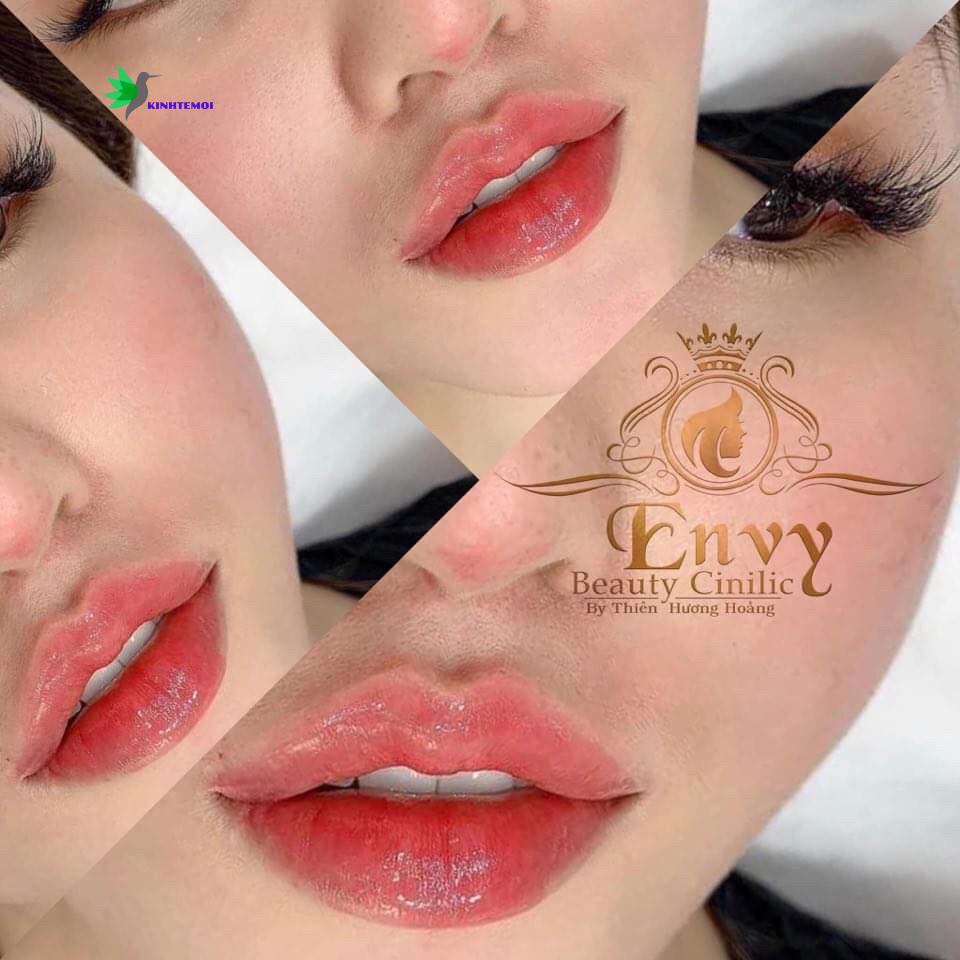 Envy luôn cung cấp những dịch vụ tốt nhất.