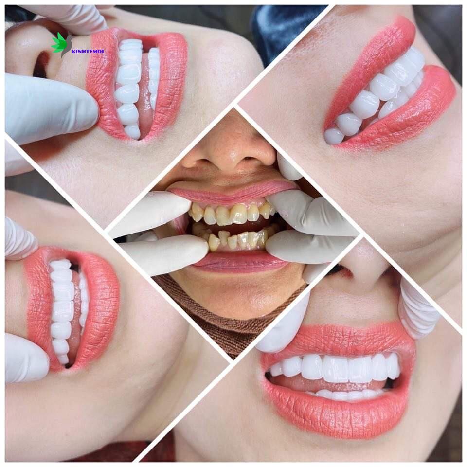 Luôn lấy phương châm làm đẹp cho khách hàng là niềm vui của Envy beauty cilinic