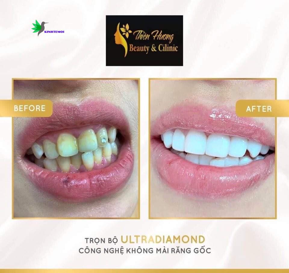 Dịch vụ của Envy beauty cilinic luôn nhận được sự hài lòng từ khách hàng.