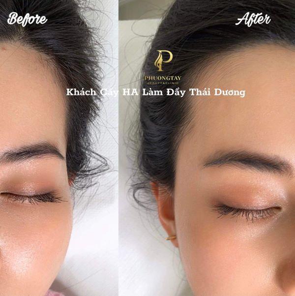 Kết quả ngoài mong đợi khi sử dụng dịch vụ tại Phương Tây Beauty
