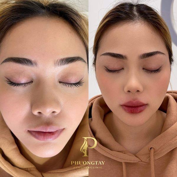 Đôi môi xinh đẹp của chị khách tại Phương Tây Beauty của CEO Lê Hoài Phương