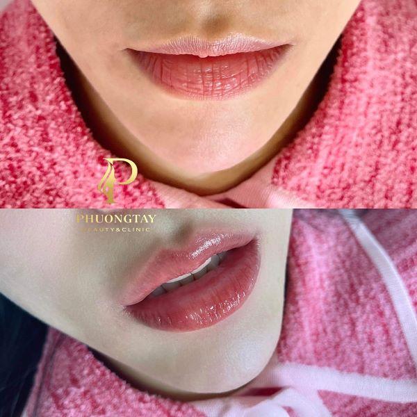 Đôi môi căng bóng tươi sáng của khách hàng tại Phương Tây Beauty của CEO Lê Hoài Phương
