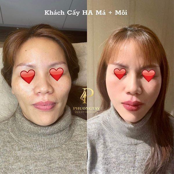 Nỗ lực cố gắng sẽ hái được quả ngọt